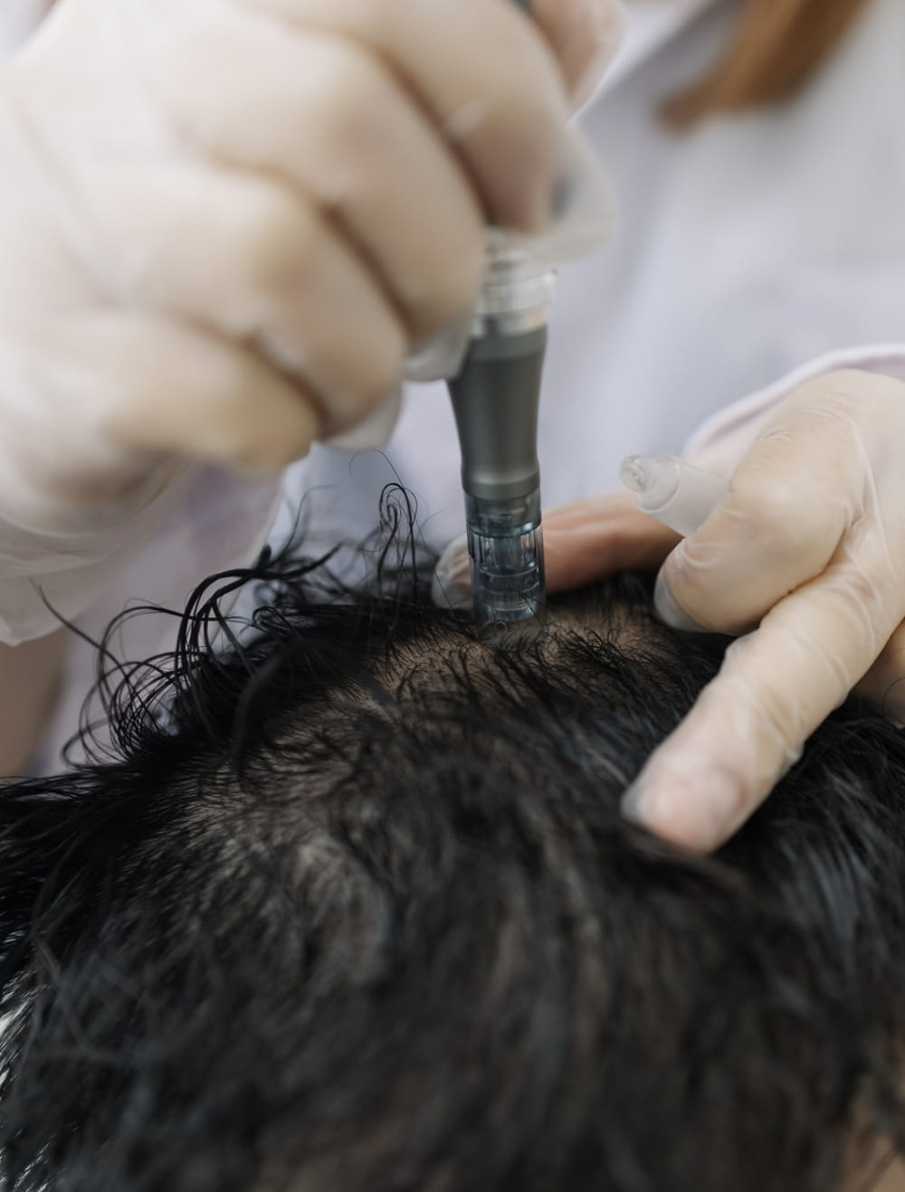 Hair Restoration Services in Plymouth, MI | PCR Centers - hair-4